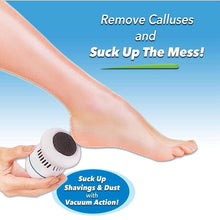 Load image into Gallery viewer, Electric Callus Remover - Built-In Vacuum Rechargeable Motorized Feet Foot Pedicure Tool Exfoliation Dead Skin